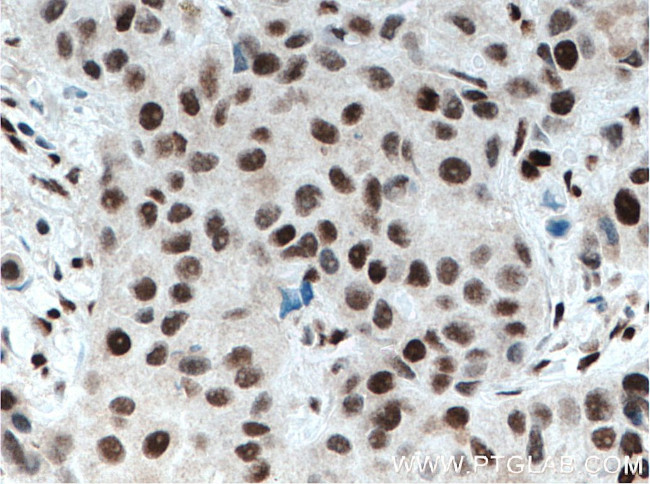 XRCC4 Antibody in Immunohistochemistry (Paraffin) (IHC (P))