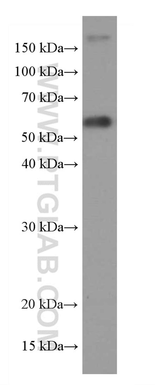 XRCC4 Antibody in Western Blot (WB)