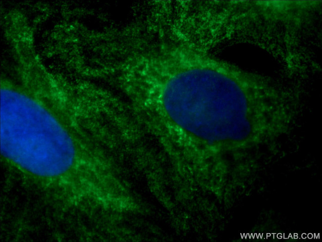 RABEPK/p40 Antibody in Immunocytochemistry (ICC/IF)