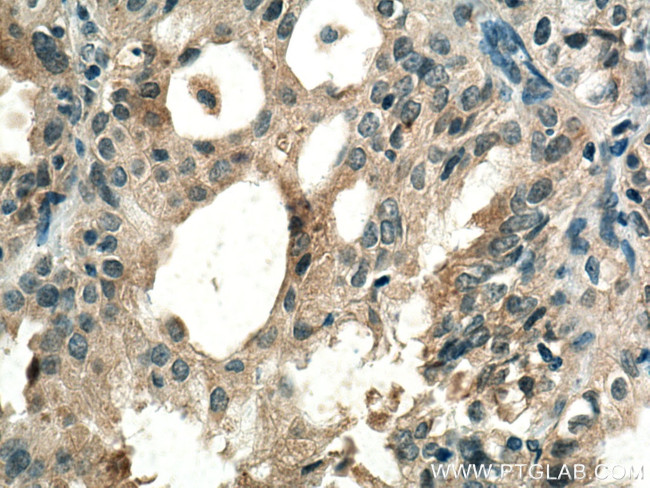 RABEPK/p40 Antibody in Immunohistochemistry (Paraffin) (IHC (P))