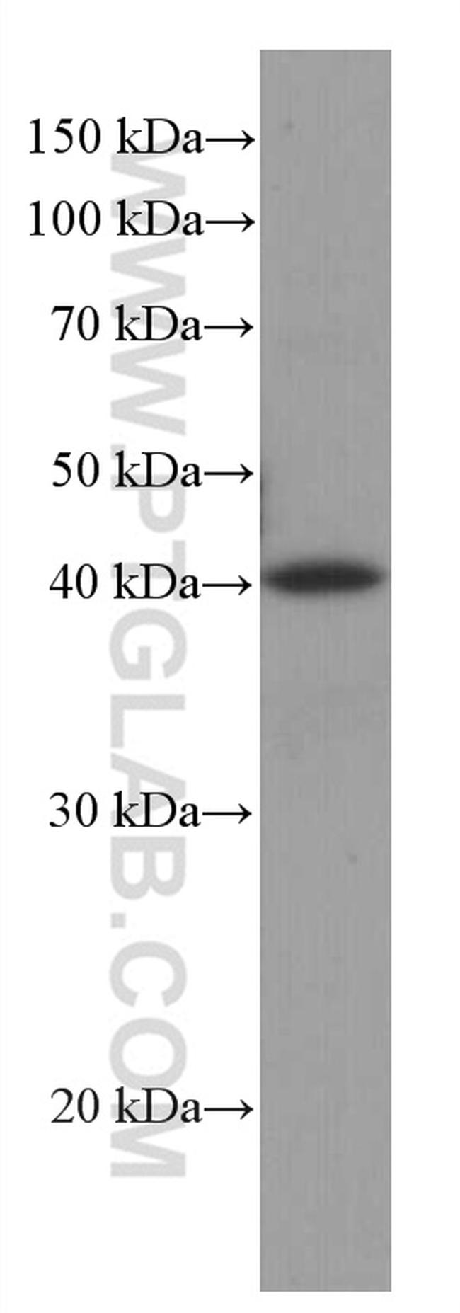 RABEPK/p40 Antibody in Western Blot (WB)