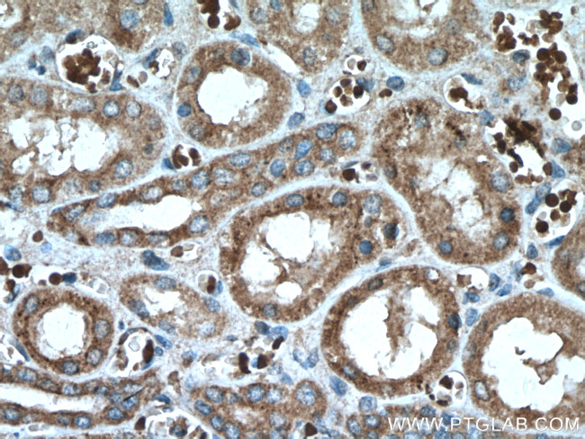 CHST4 Antibody in Immunohistochemistry (Paraffin) (IHC (P))