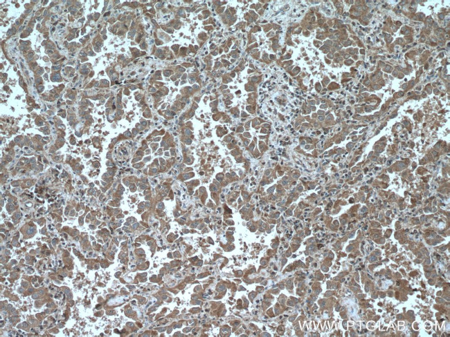 CHST4 Antibody in Immunohistochemistry (Paraffin) (IHC (P))