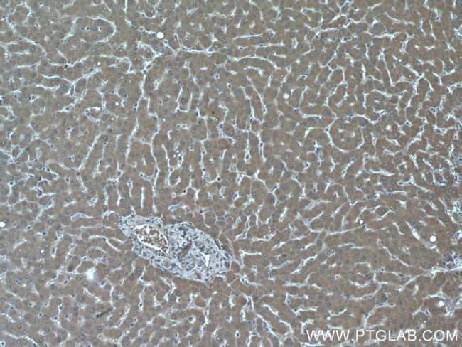 CHST4 Antibody in Immunohistochemistry (Paraffin) (IHC (P))