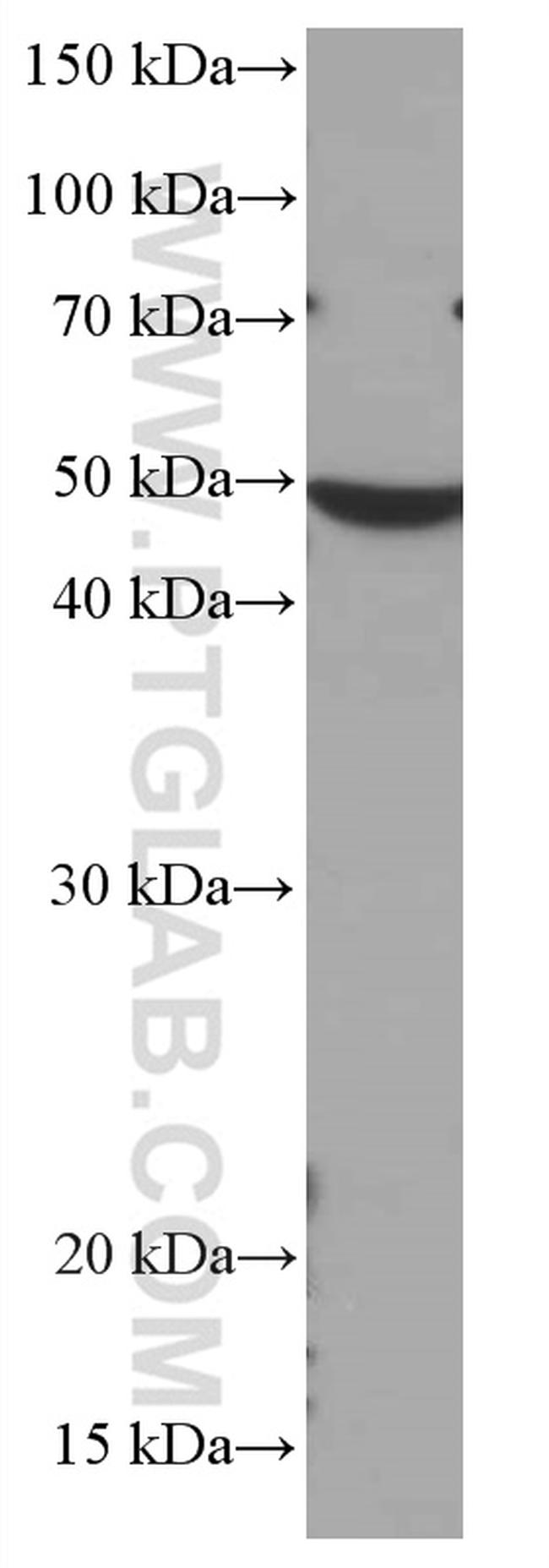 CHST4 Antibody in Western Blot (WB)