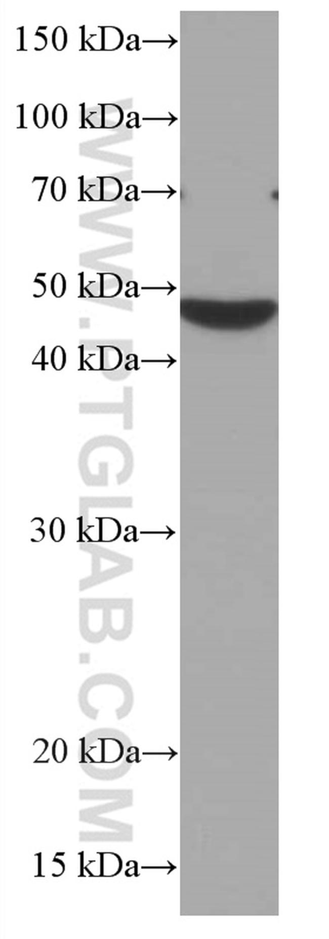 CHST4 Antibody in Western Blot (WB)