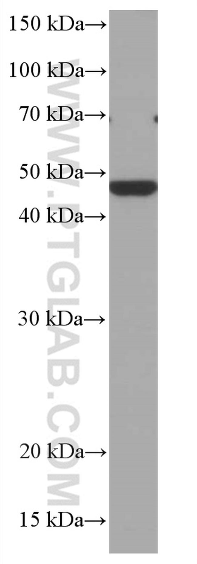 CHST4 Antibody in Western Blot (WB)