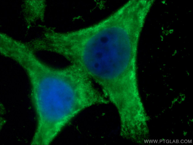 GSTA1 Antibody in Immunocytochemistry (ICC/IF)