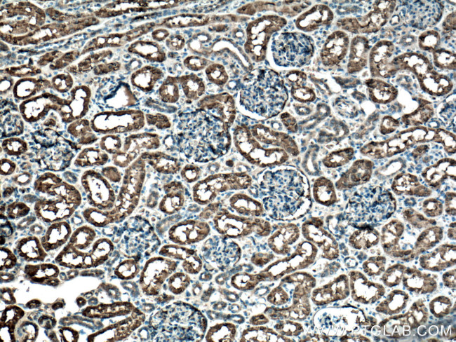 GSTA1 Antibody in Immunohistochemistry (Paraffin) (IHC (P))