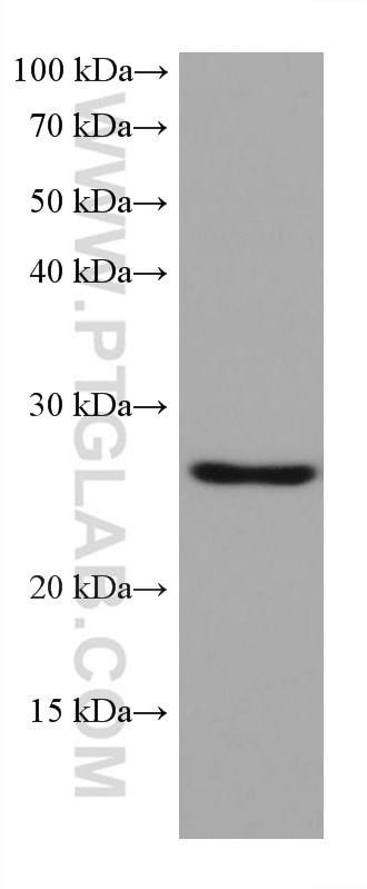 GSTA1 Antibody in Western Blot (WB)