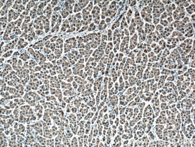 GSTA1 Antibody in Immunohistochemistry (Paraffin) (IHC (P))