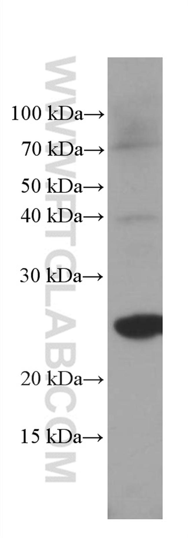 GSTA1 Antibody in Western Blot (WB)