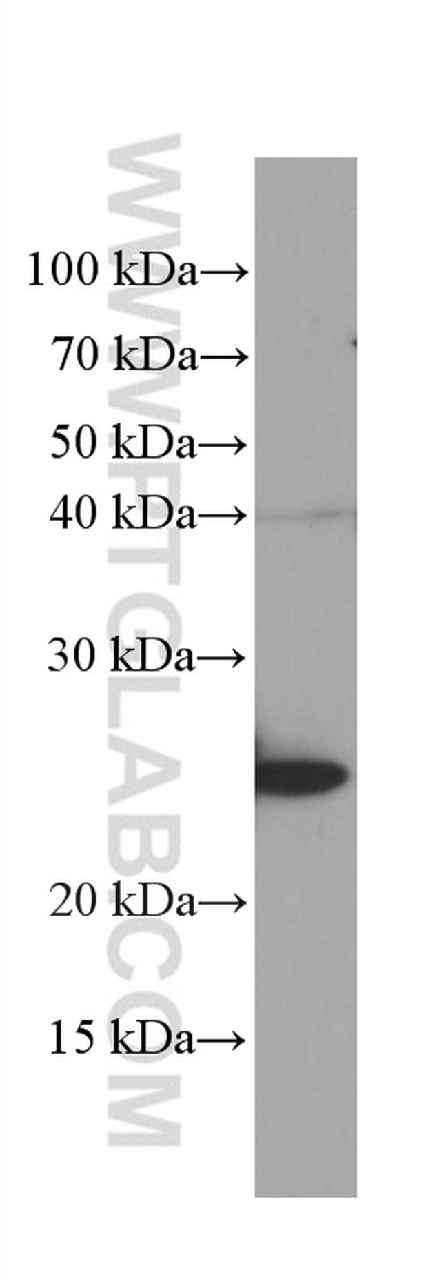 GSTA1 Antibody in Western Blot (WB)