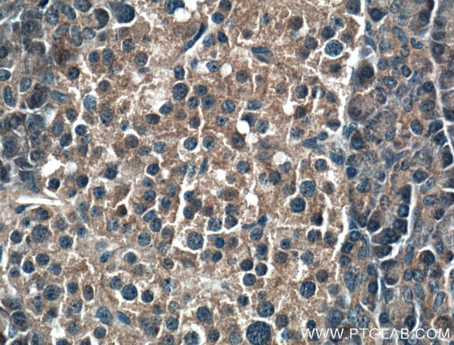 RIC8A Antibody in Immunohistochemistry (Paraffin) (IHC (P))