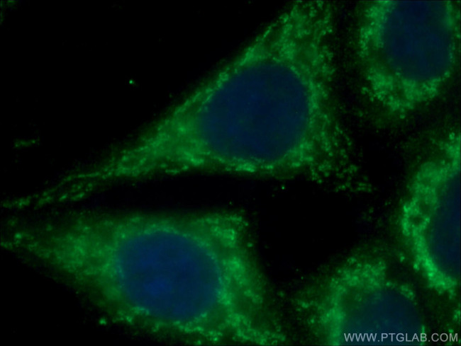 cIAP1 Antibody in Immunocytochemistry (ICC/IF)