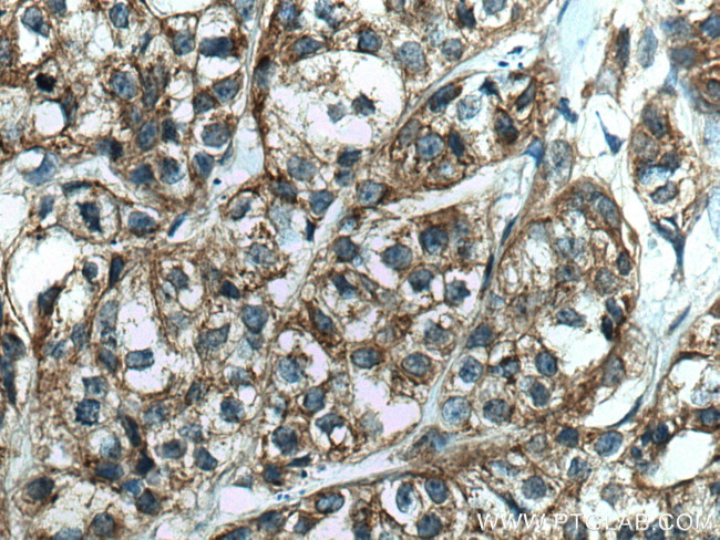 FAF2 Antibody in Immunohistochemistry (Paraffin) (IHC (P))