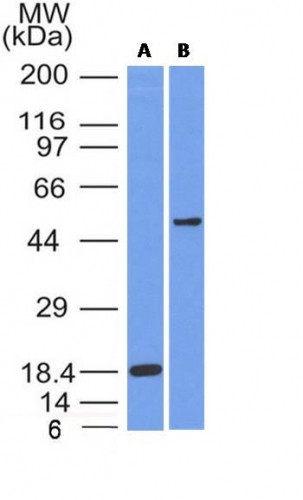 SOX10 (Melanoma Marker) Antibody in Western Blot (WB)