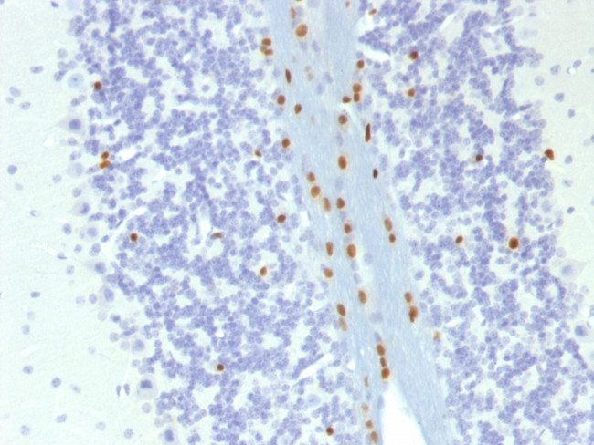 SOX10 (Melanoma Marker) Antibody in Immunohistochemistry (Paraffin) (IHC (P))