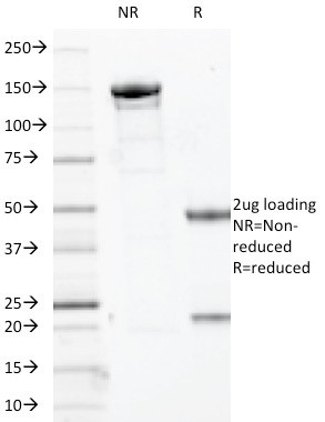 SOX10 (Melanoma Marker) Antibody in SDS-PAGE (SDS-PAGE)