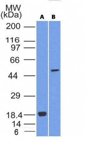 SOX10 (Melanoma Marker) Antibody in Western Blot (WB)