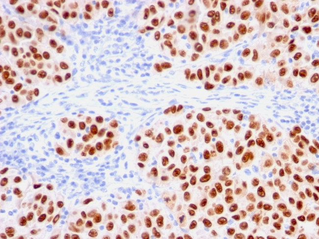 SOX10 Antibody in Immunohistochemistry (Paraffin) (IHC (P))