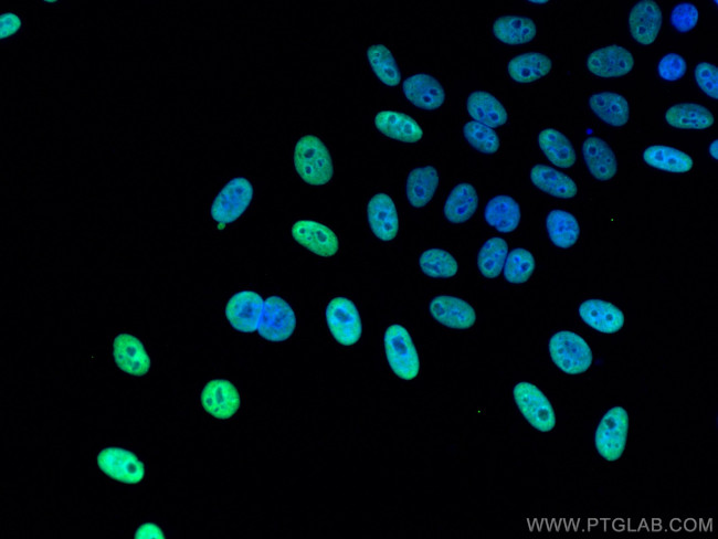 KAP1 Antibody in Immunocytochemistry (ICC/IF)