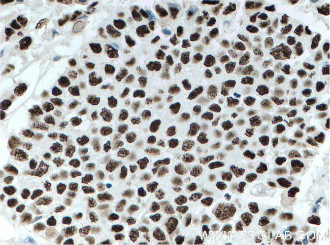 KAP1 Antibody in Immunohistochemistry (Paraffin) (IHC (P))