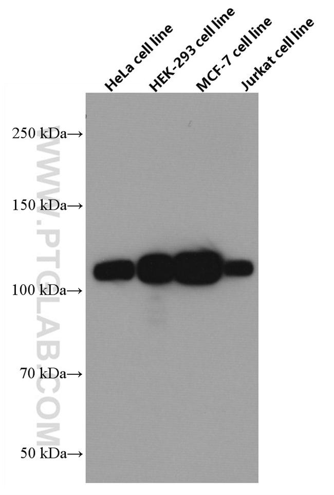 KAP1 Antibody in Western Blot (WB)