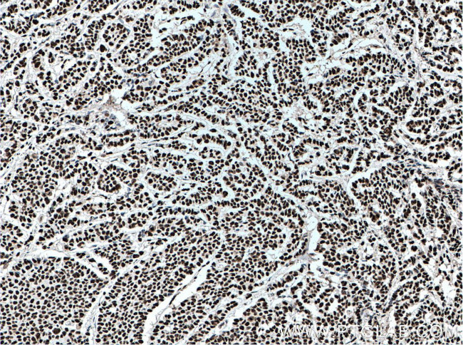 KAP1 Antibody in Immunohistochemistry (Paraffin) (IHC (P))