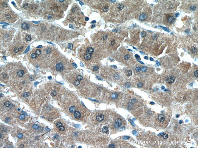 ROCK2 Antibody in Immunohistochemistry (Paraffin) (IHC (P))