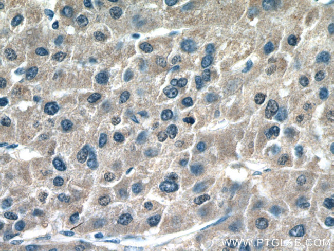 ROCK2 Antibody in Immunohistochemistry (Paraffin) (IHC (P))