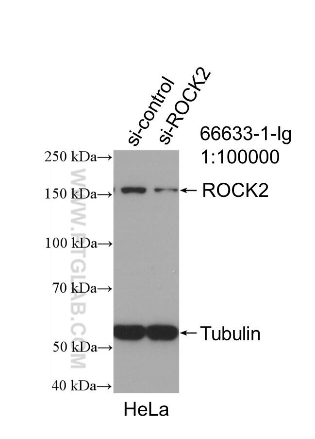 ROCK2 Antibody in Western Blot (WB)