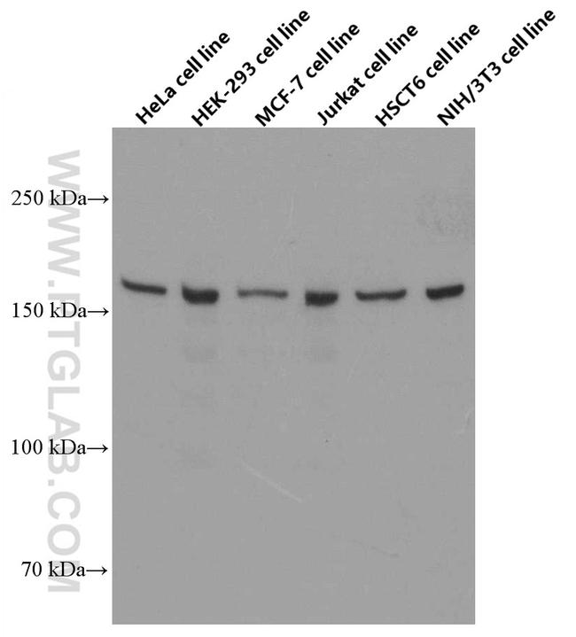 ROCK2 Antibody in Western Blot (WB)