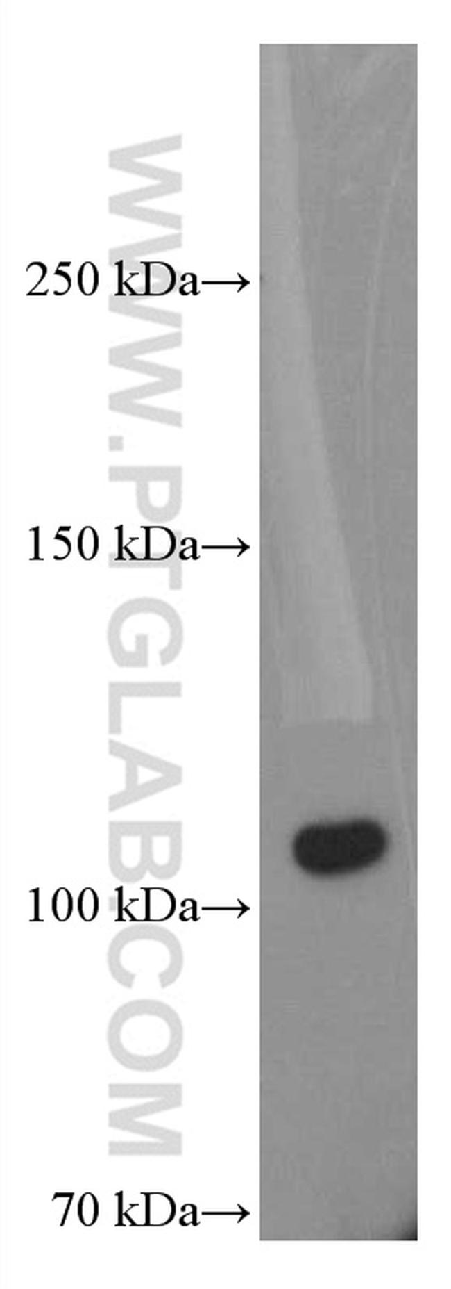 C5 Antibody in Western Blot (WB)