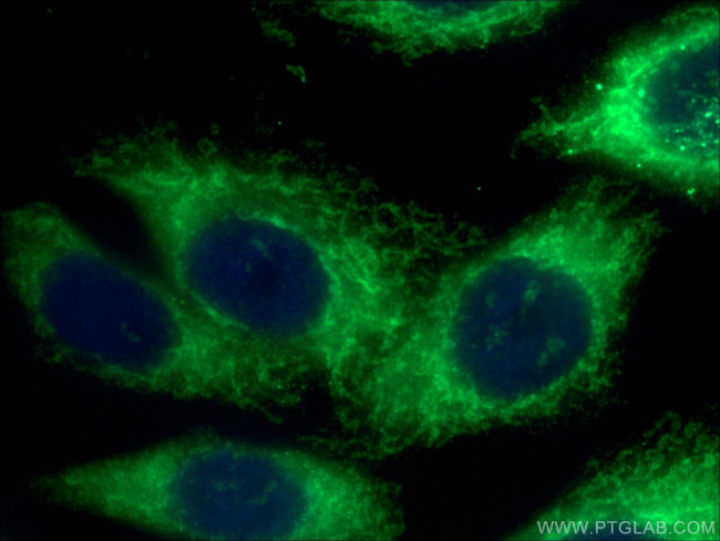 FIS1 Antibody in Immunocytochemistry (ICC/IF)