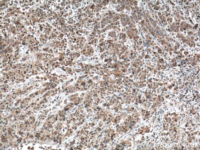 FIS1 Antibody in Immunohistochemistry (Paraffin) (IHC (P))