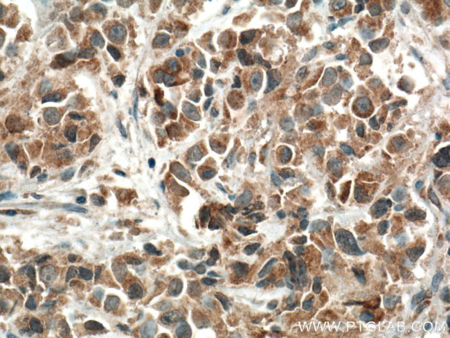 FIS1 Antibody in Immunohistochemistry (Paraffin) (IHC (P))