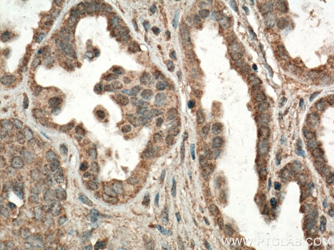 FIS1 Antibody in Immunohistochemistry (Paraffin) (IHC (P))