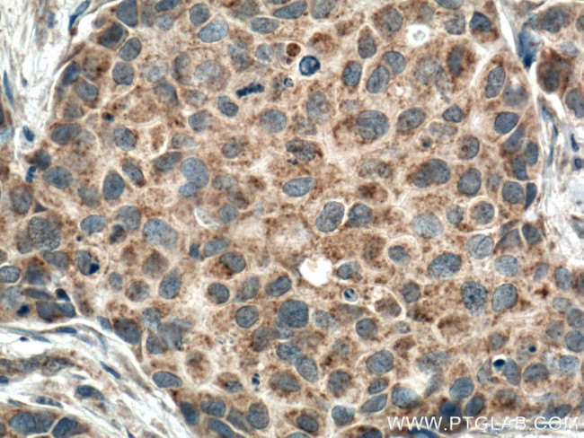 FIS1 Antibody in Immunohistochemistry (Paraffin) (IHC (P))