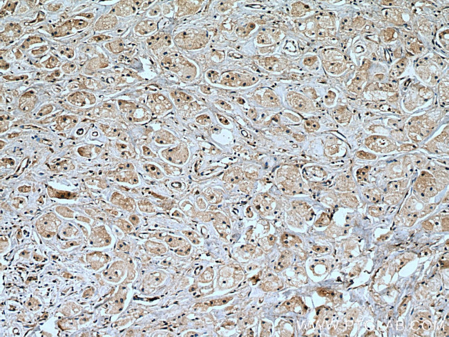 TGFBR2 Antibody in Immunohistochemistry (Paraffin) (IHC (P))