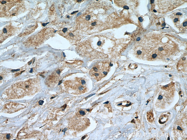 TGFBR2 Antibody in Immunohistochemistry (Paraffin) (IHC (P))