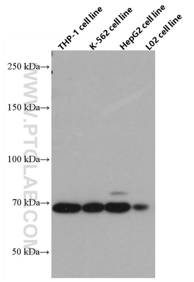 TGFBR2 Antibody in Western Blot (WB)