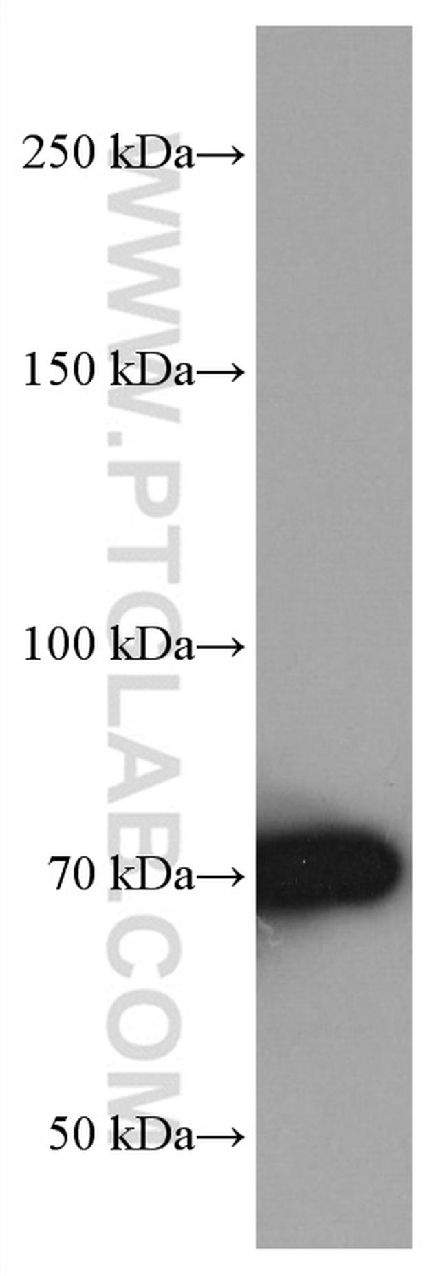 TGFBR2 Antibody in Western Blot (WB)