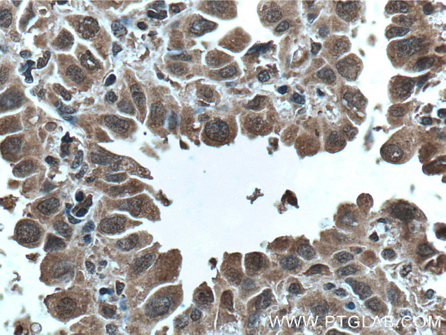 p70(S6K) Antibody in Immunohistochemistry (Paraffin) (IHC (P))