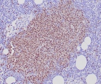 SOX11 (Mantle Cell Lymphoma Marker) Antibody in Immunohistochemistry (Paraffin) (IHC (P))