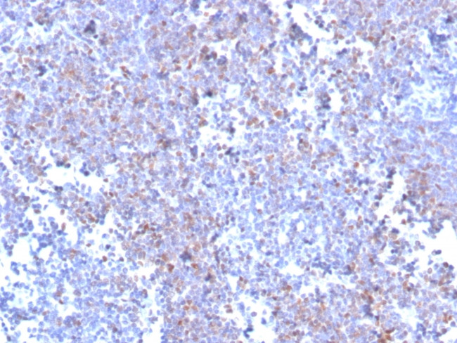 SOX11 (Mantle Cell Lymphoma Marker) Antibody in Immunohistochemistry (Paraffin) (IHC (P))