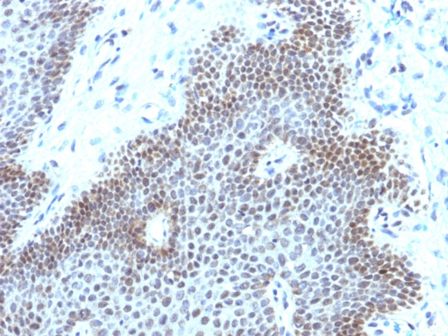 SOX11 (Mantle Cell Lymphoma Marker) Antibody in Immunohistochemistry (Paraffin) (IHC (P))