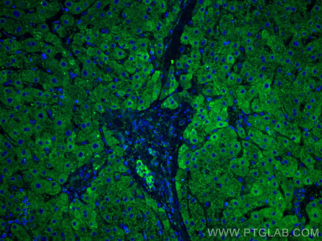 ANGPTL8 Antibody in Immunohistochemistry (PFA fixed) (IHC (PFA))