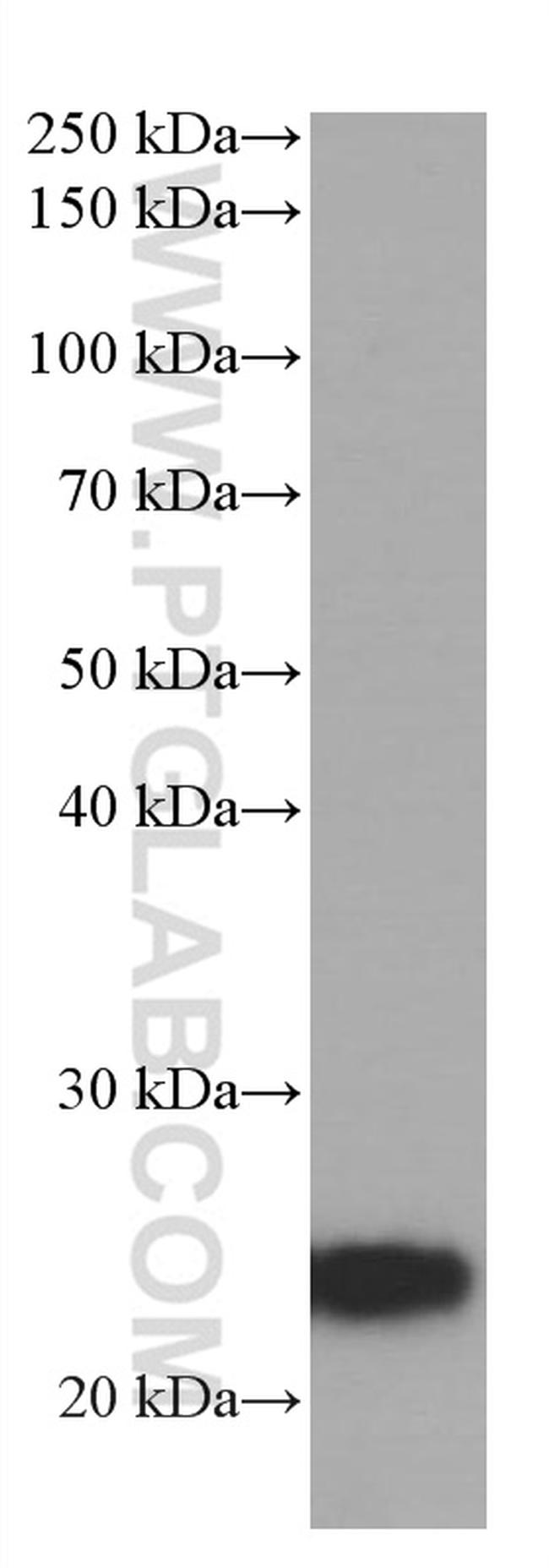 ANGPTL8 Antibody in Western Blot (WB)