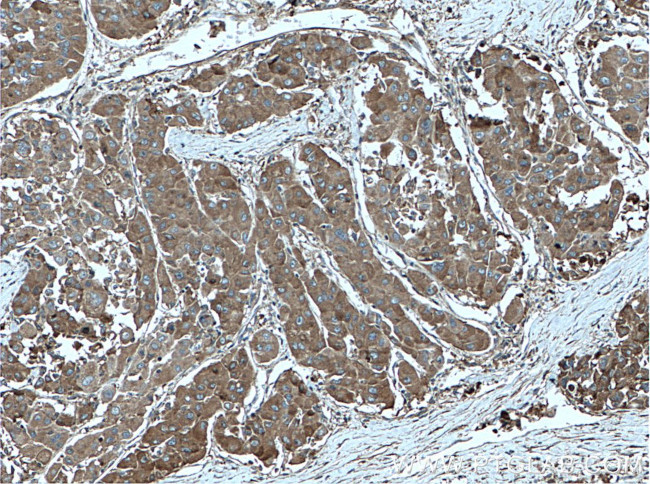 ANGPTL8 Antibody in Immunohistochemistry (Paraffin) (IHC (P))